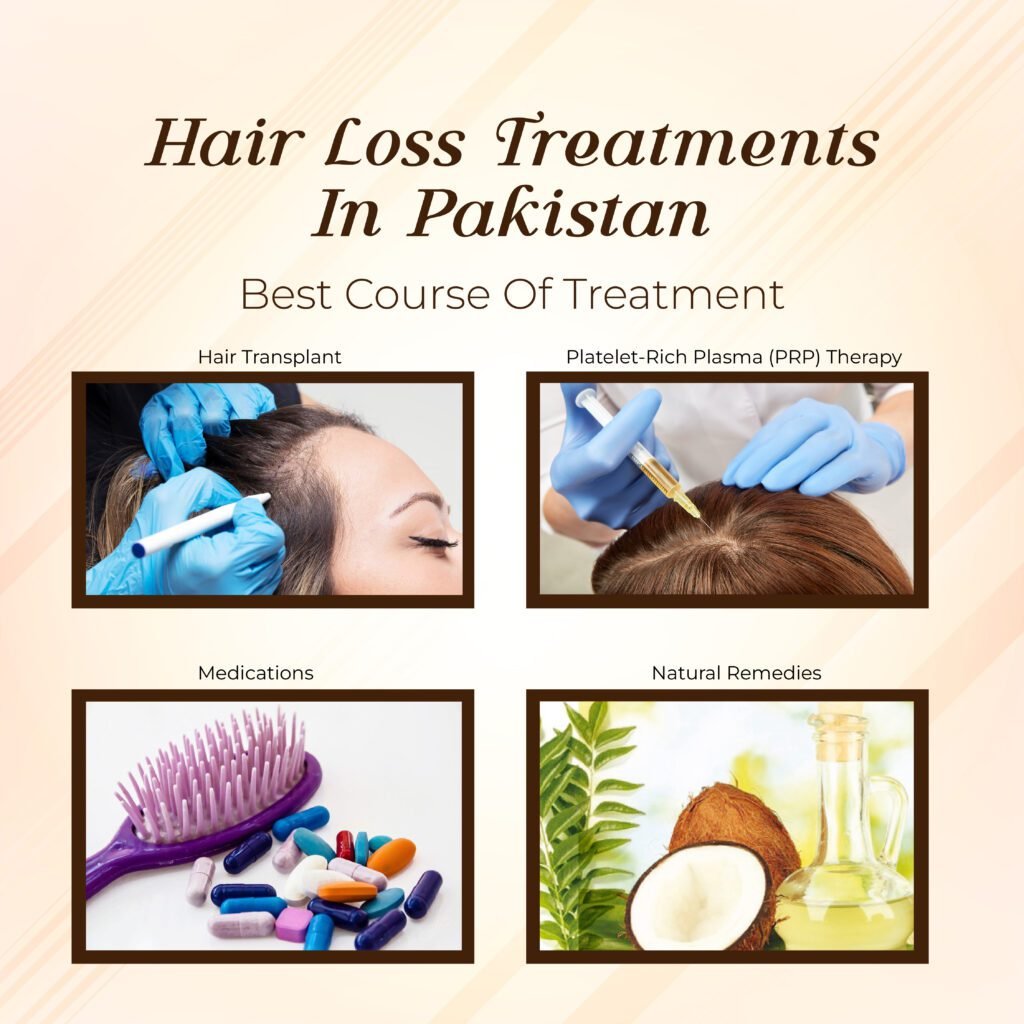 Hair loss treatment in Pakistan